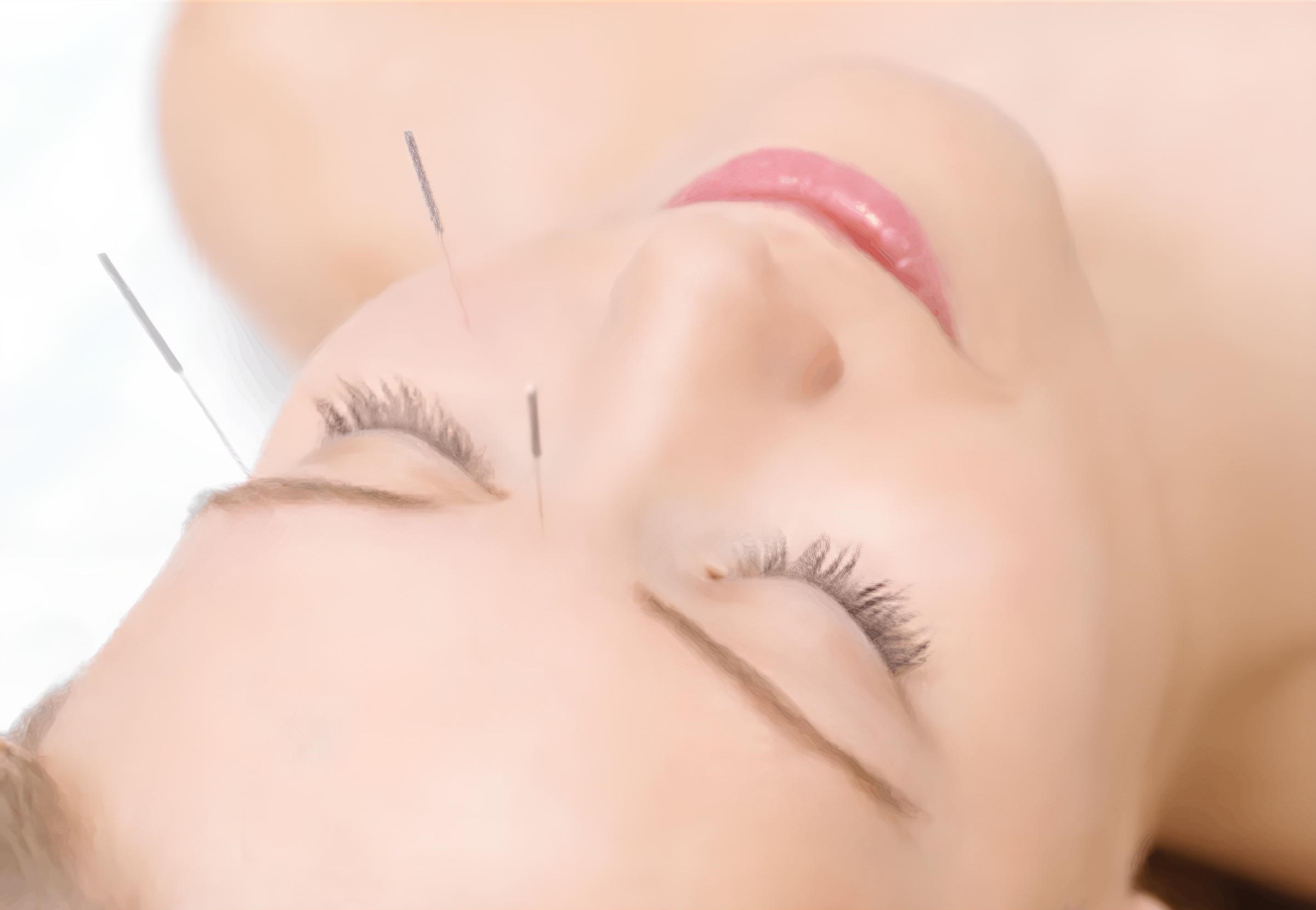 Eye Acupuncture